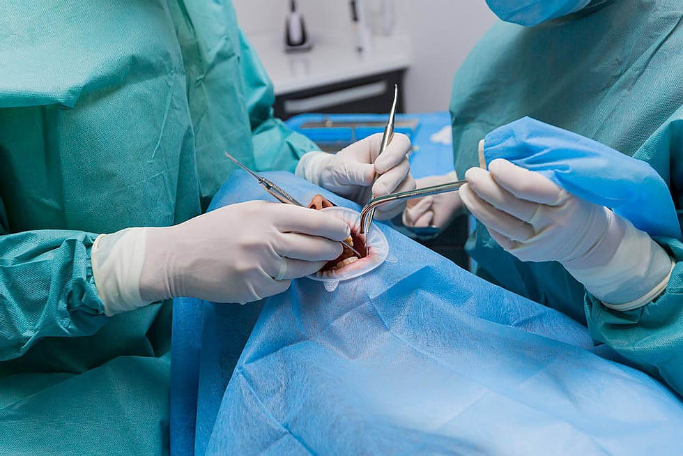 cirurgião dentista operando um paciente para retirar as bolsas de Bichat.