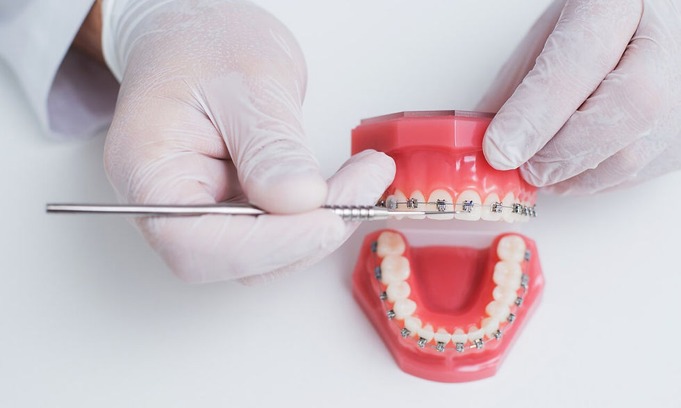 ortodontista mostra como é organizado o sistema de aparelho nos dentes