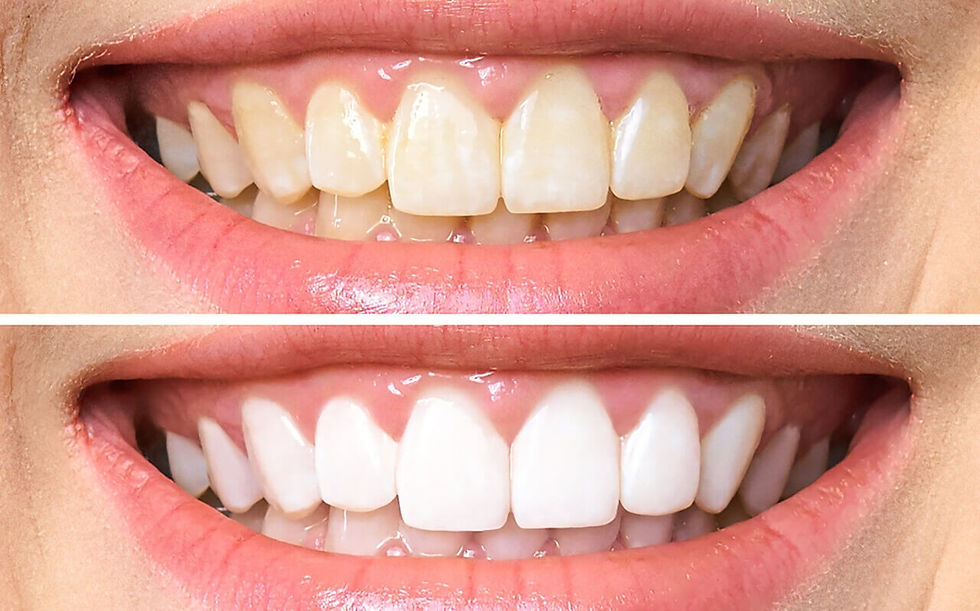 foto de antes e depois na odontologia